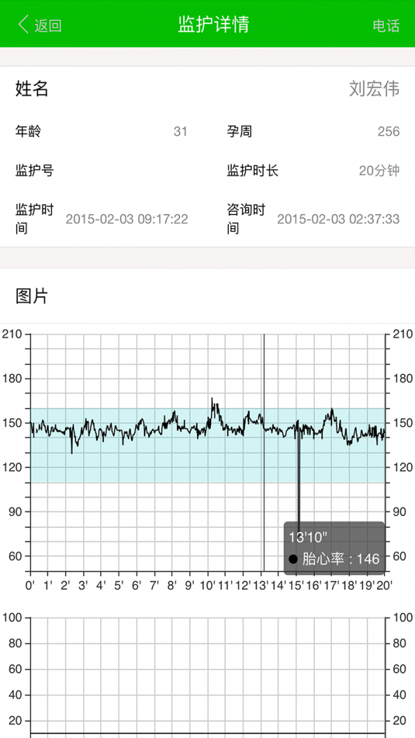 易胎心医生版截图2